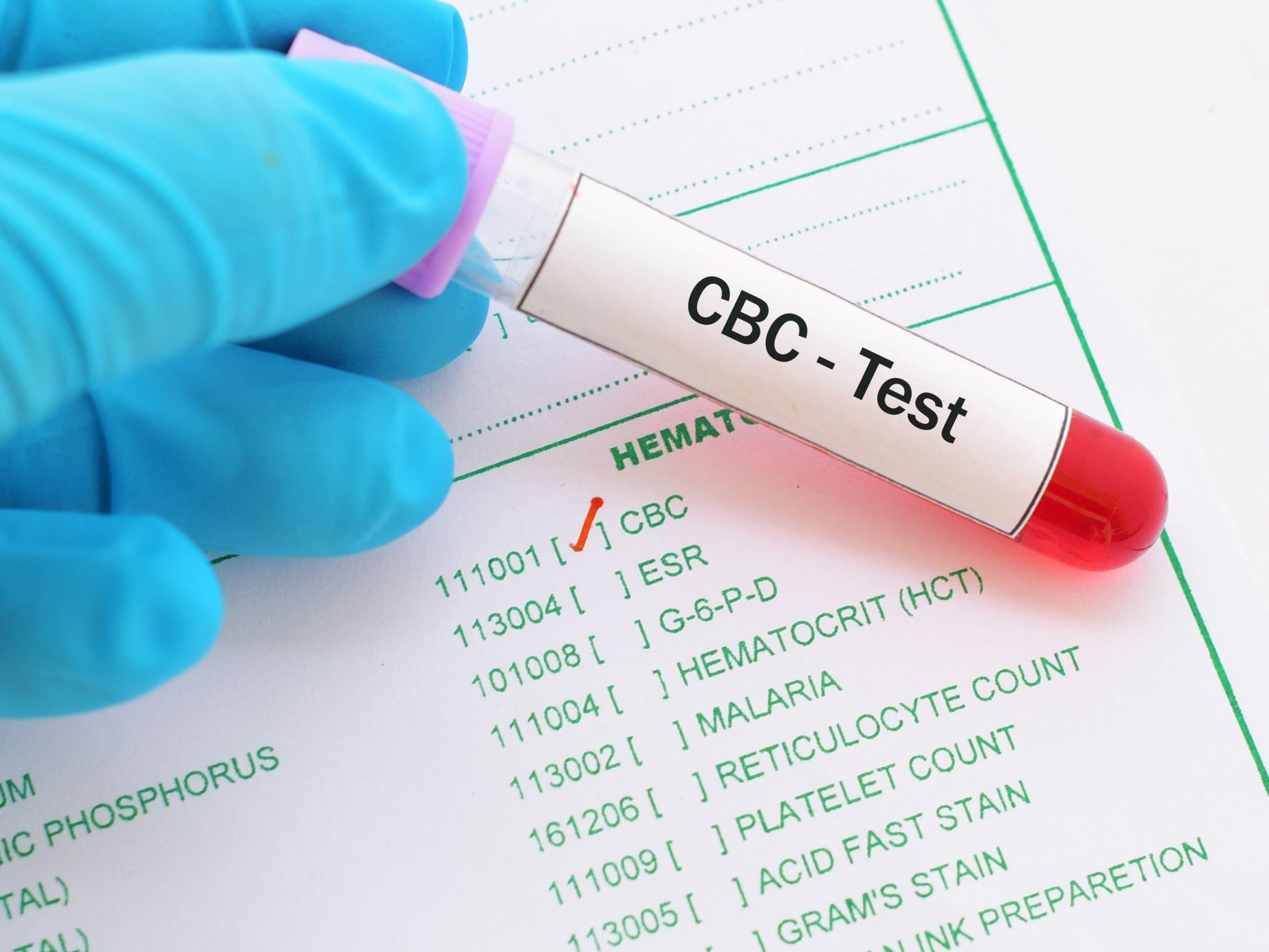 Complete Blood Count (CBC)